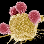 Атакующая рак иммунотерапия