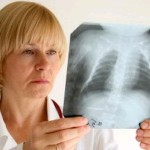 Больных туберкулезом спасут немецкие фильтры 