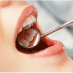 Киста и гранулема зуба: симптомы и диагностика