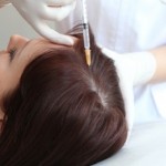 Мезотерапия для волос: как и зачем проводят процедуру