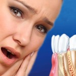Незаметный пародонтоз лишает зубов