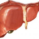 Острый гепатит: болезнь пораженной печени