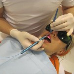 Лазер в стоматологии: зачем применяют