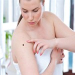 Что необходимо знать о раке кожи