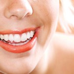 Отбеливание зубов: что думают стоматологи