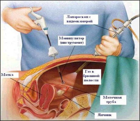 Хирургическое лечение