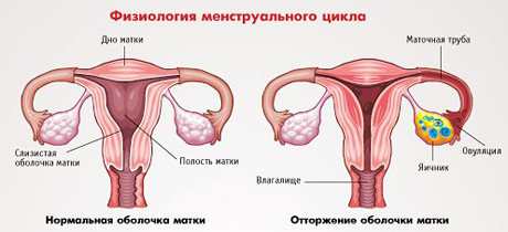 Отсутствие менструации