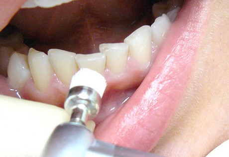 Уход за полостью рта и зубами