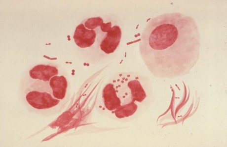 Гонорея вызывается бактерией гонококка Neisseria