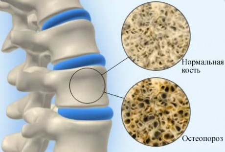 болезни костно мышечной системы