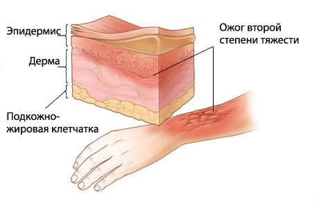 травмы и отравления