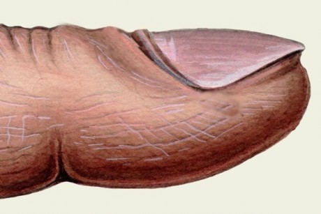 Если отслаиваются ногти ...