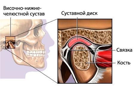 Дисфункция височно-нижнечелюстного сустава: особенности