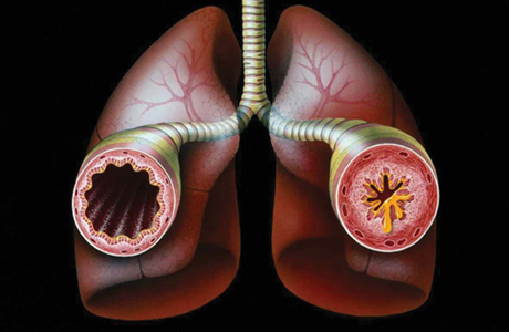 Астма: старшее поколение рискует особенно